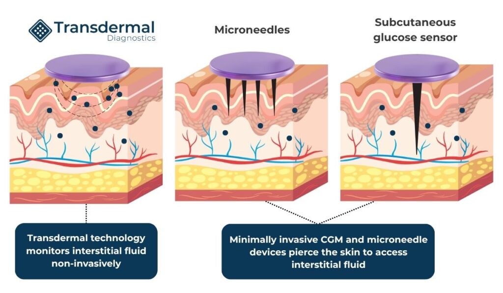 Comparison between the Transdermal Diagnostics platform and traditional CGMs or microneedle based sensors. The Transdermal Diagnostics system is entirely needle-free and uses no needles to monitor glucose.